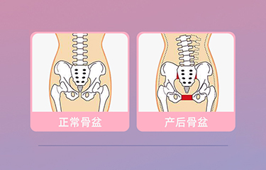 盆底肌修復(fù)儀器怎么樣？哪些人可以使用它呢