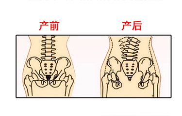 月子期間盆骨儀器修復(fù)時(shí)間有限制嗎？與手法修復(fù)相比哪個(gè)效果好？